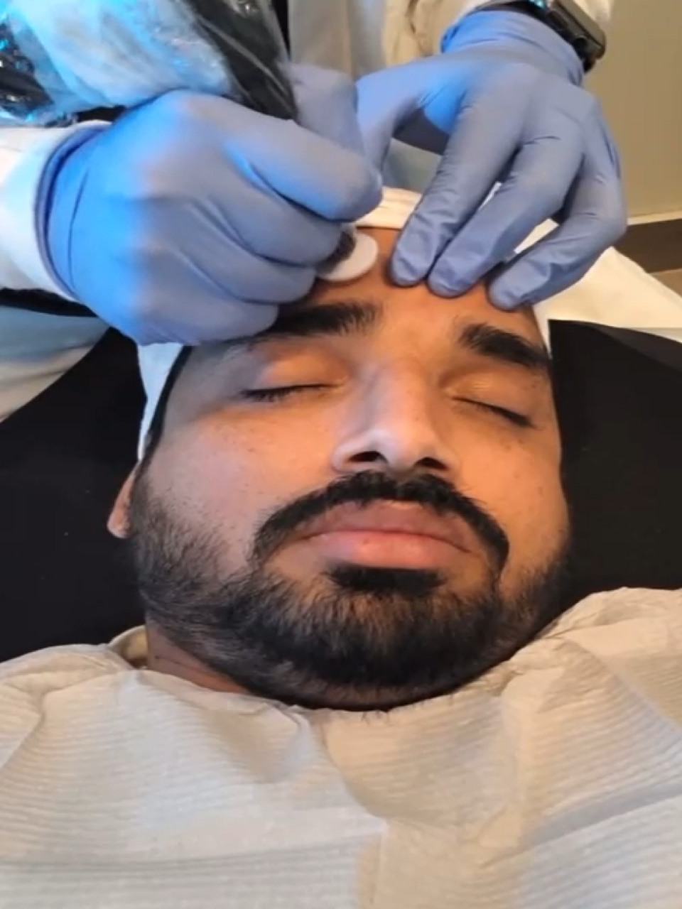 Microchanneling-microneedling-website